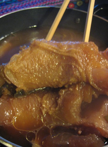 check if tendon is tender